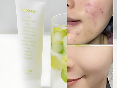 ELIMERE Cabbage Acne Foam Cleanser 120ml Supply